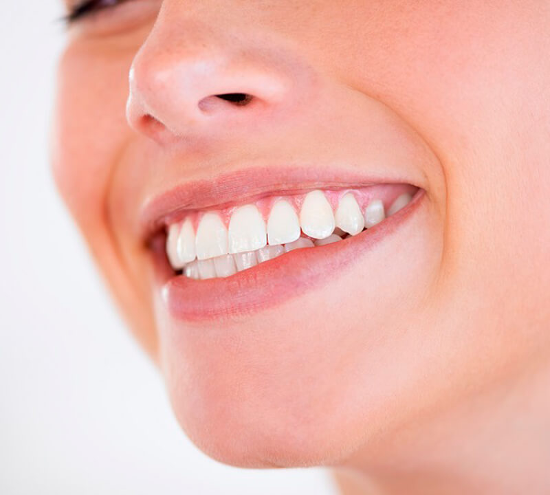 Estética dental: Conheça as técnicas utilizadas