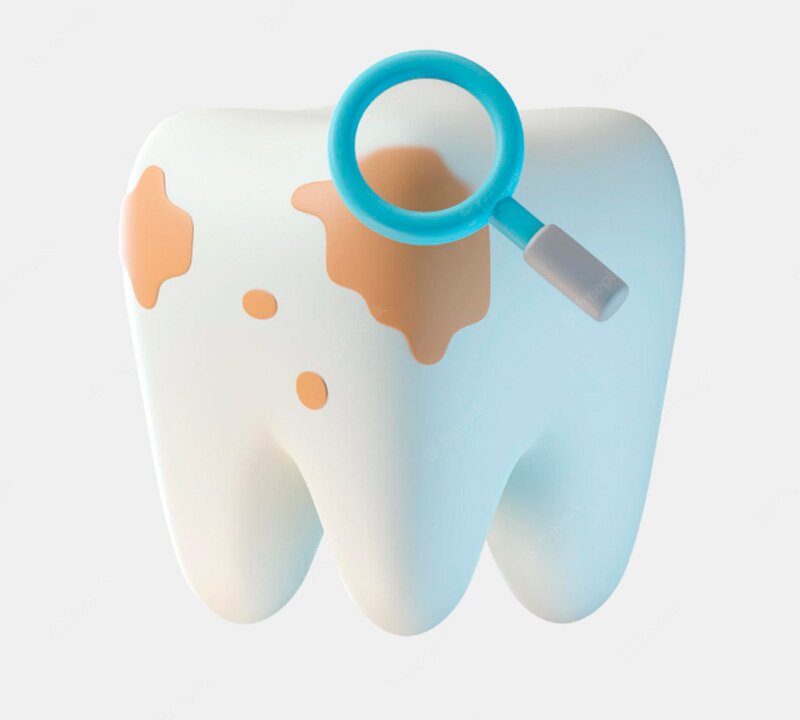 CORROSÃO DO ESMALTE DOS DENTES – COMO EVITAR?