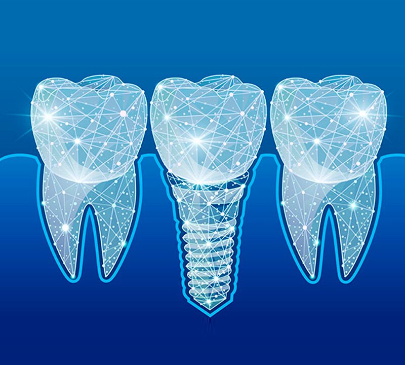 É normal o implante dentario doer?