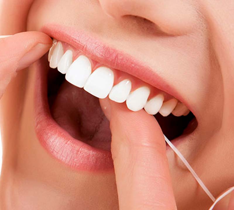 Como passar o fio dental corretamente