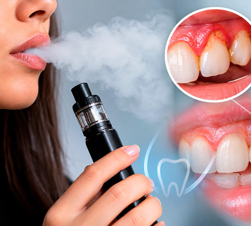 Cigarro eletrônico e saúde bucal - Dentista Mooca